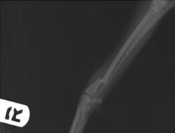 トイ犬種の前肢骨折